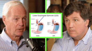 Ron Johnson and Tucker Carlson discuss acid reflux and LES diagram